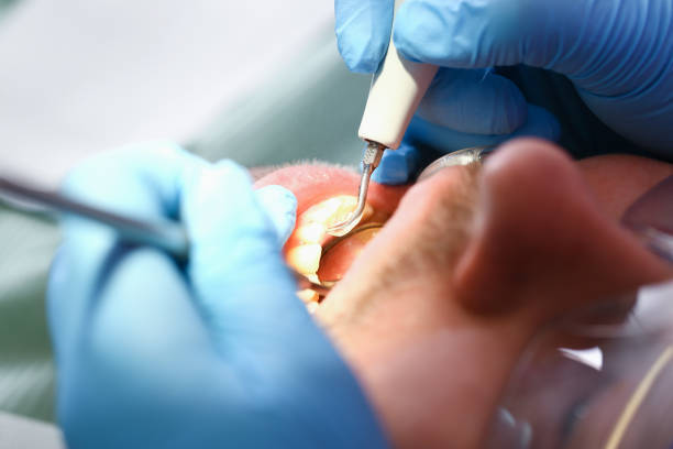 Best Urgent Tooth Repair  in Underwood Petersville, AL