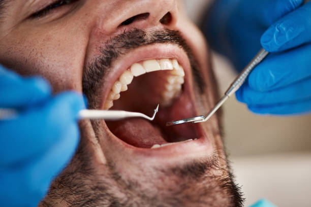Best Cracked Tooth Emergency Dentist  in Underwood Petersville, AL