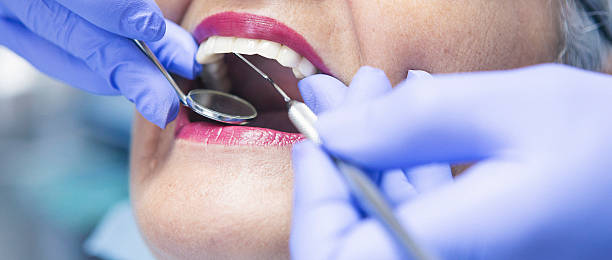 Best Emergency Tooth Extraction  in Underwood Petersville, AL